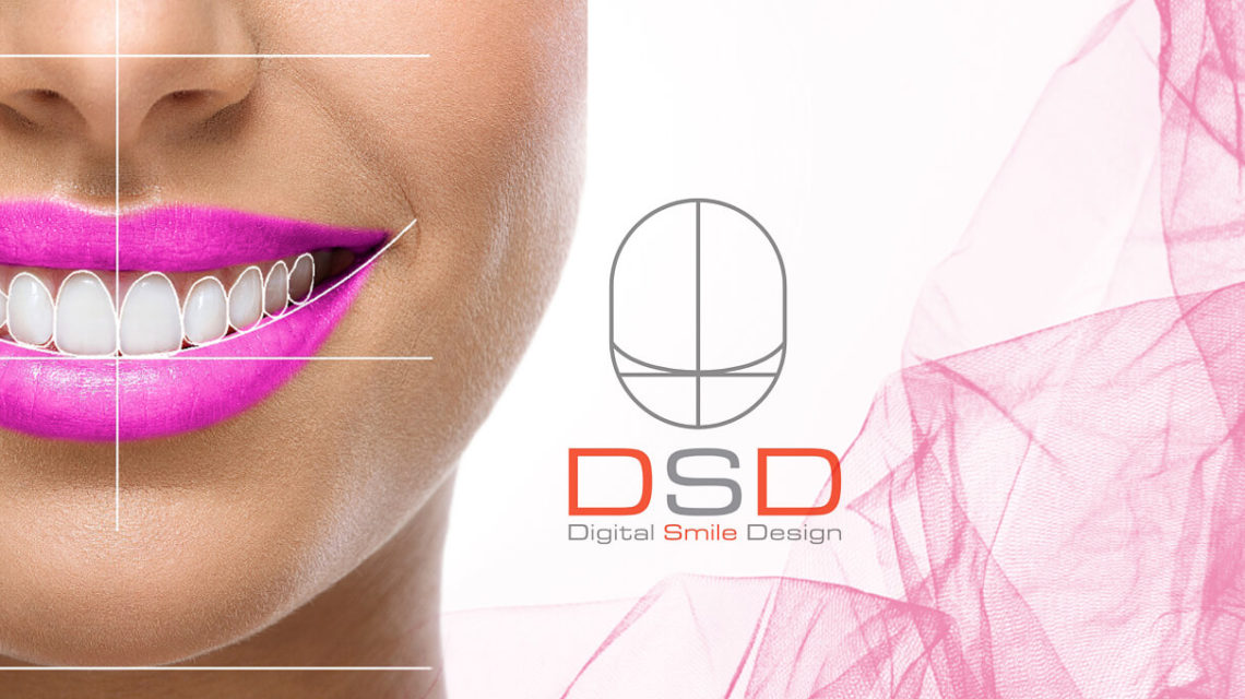 Digital Smile Designing
