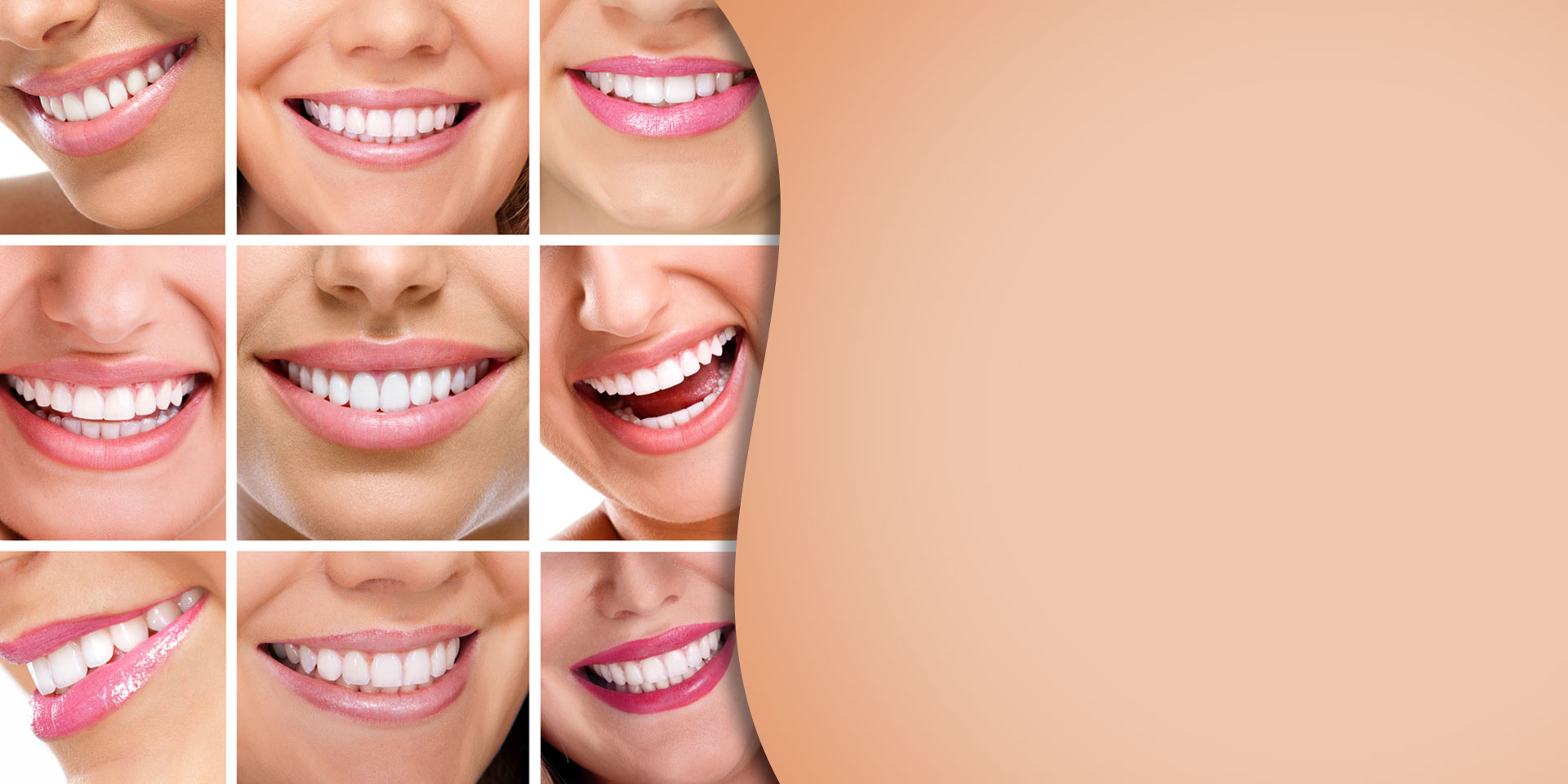 Digital Smile Designing, Best Orthodontist Gurgaon